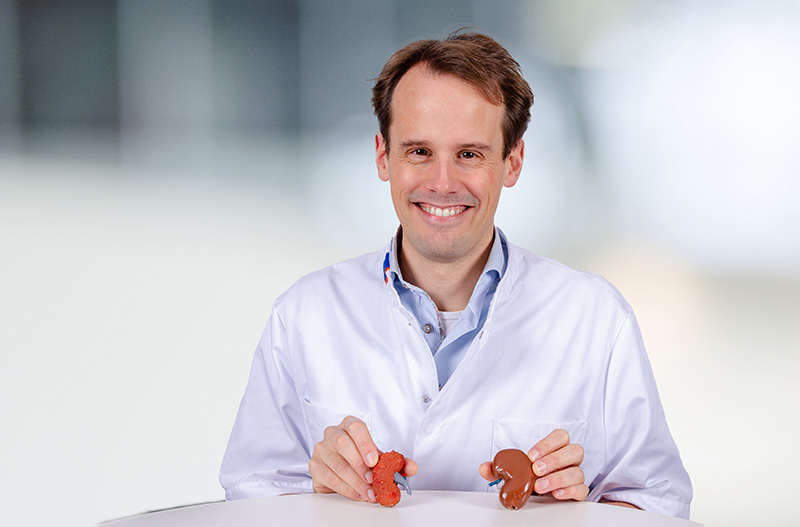 Martin de Borst met een gezonde nier (rechts) en nier met schade