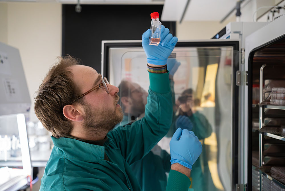Cellen organ on a chip