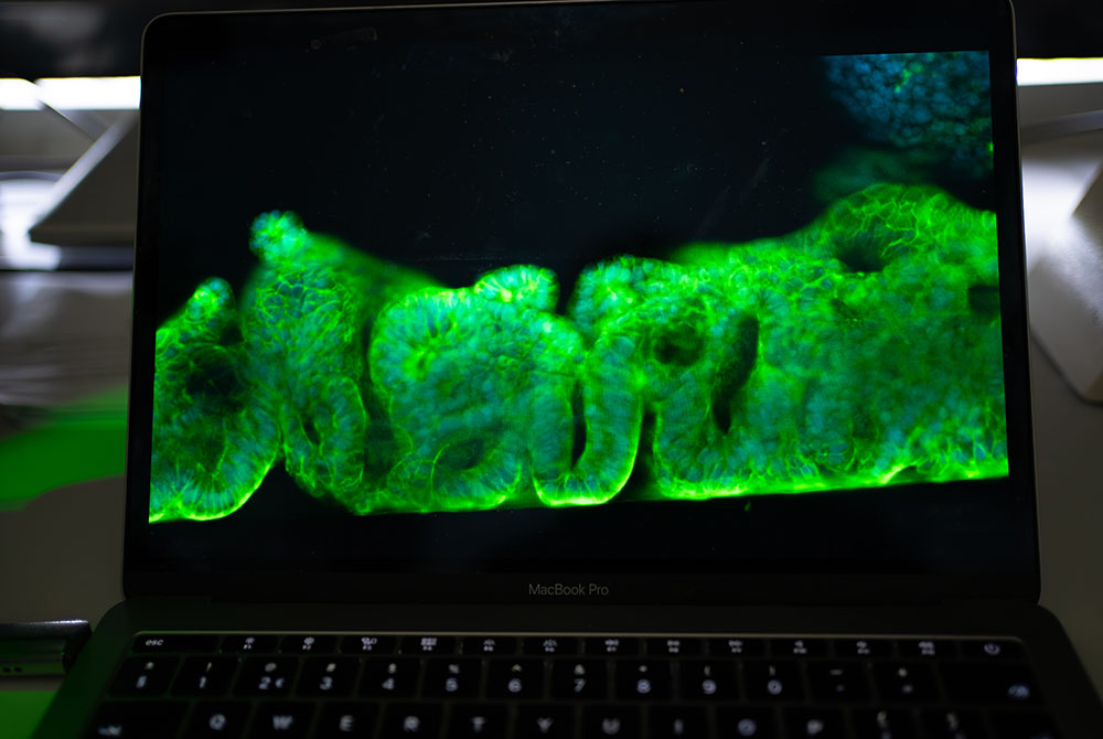 Darmcellen onder de microscoop laptop