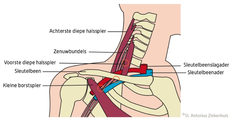 Vaatzenuwbundel TOS